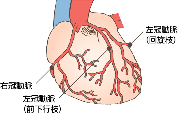 冠動脈の位置 イラスト
